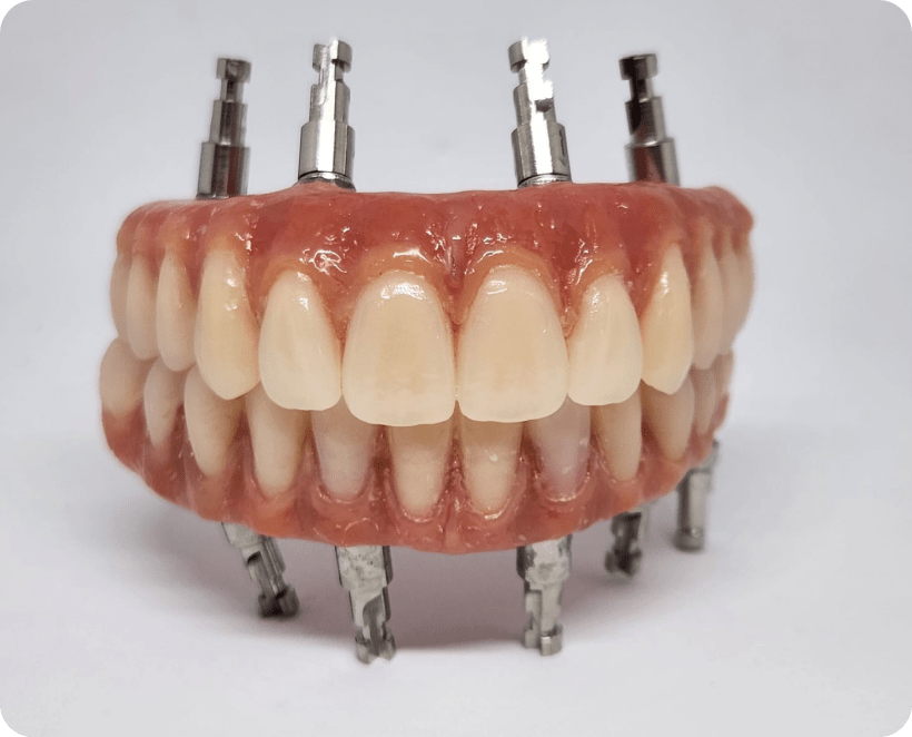 Trabalho de prótese sobre implantes